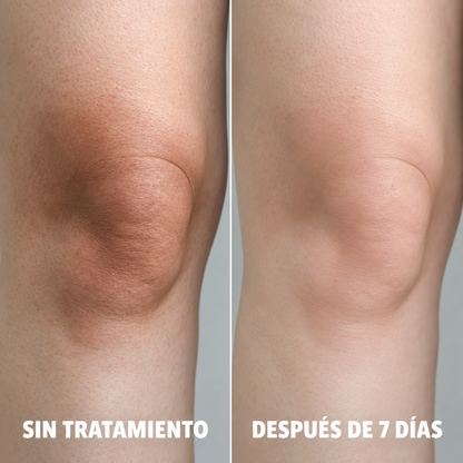 NUPELLE | Atenuá las manchas del sol y la edad mientras dormís