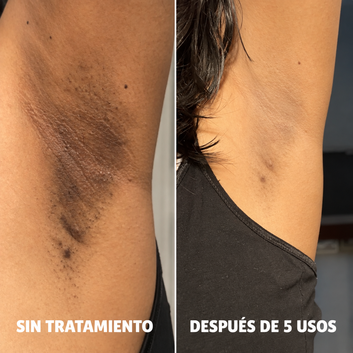 NUPELLE | Atenuá las manchas del sol y la edad mientras dormís